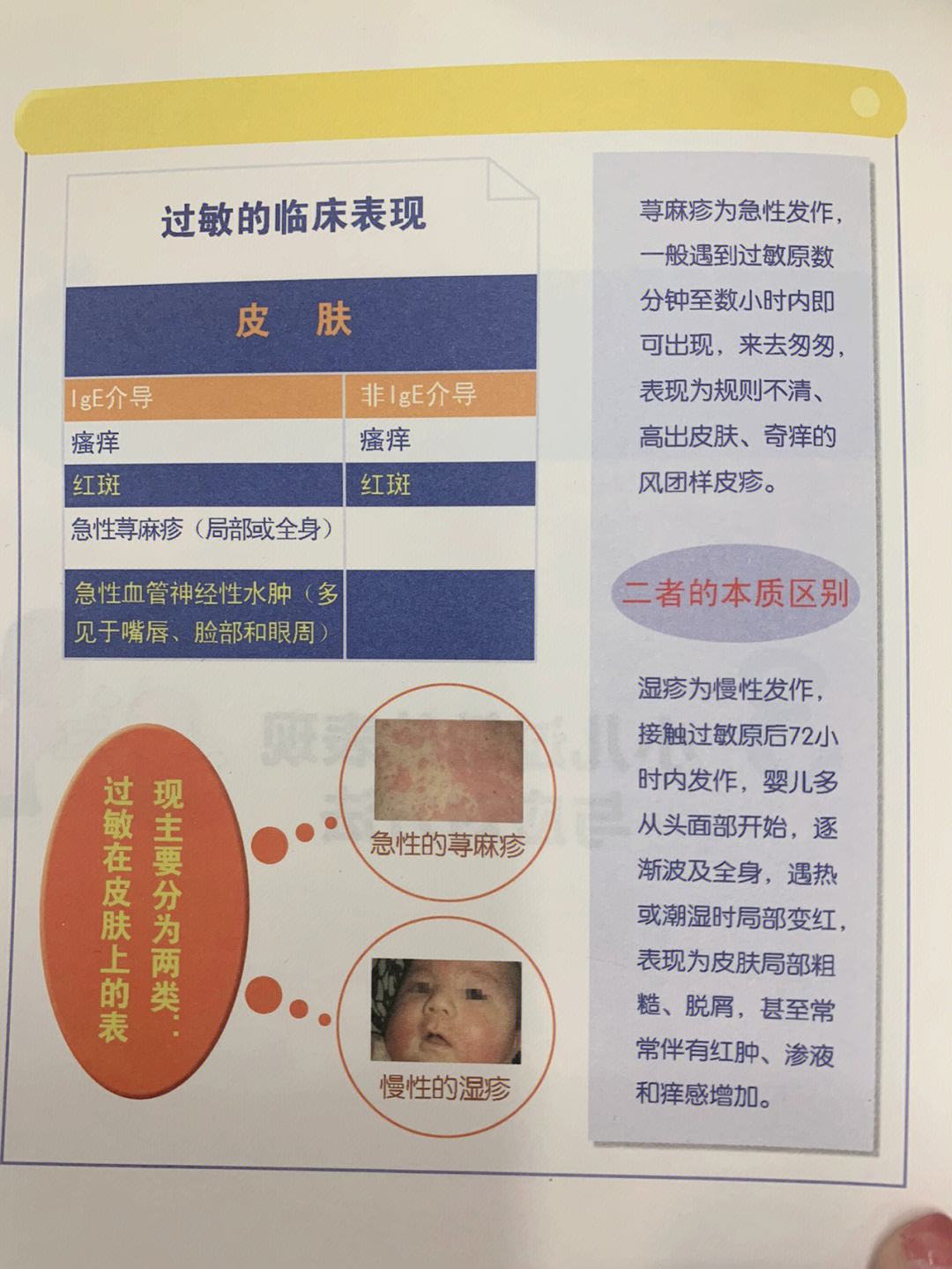 什么是脱敏期(什么叫脱敏治疗怎么治) 什么是脱敏期(什么叫脱敏治疗怎么治)